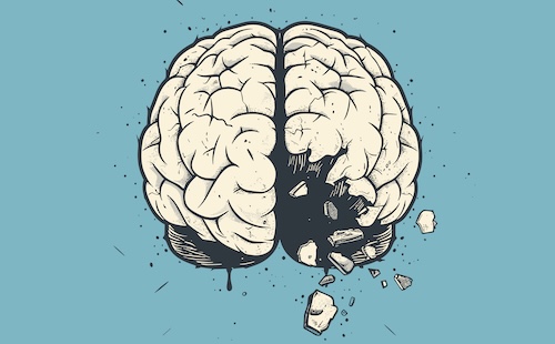 Teaching critical thinking skills helps to ensure students are active and engaged--and that they aren't falling victim to brain rot.